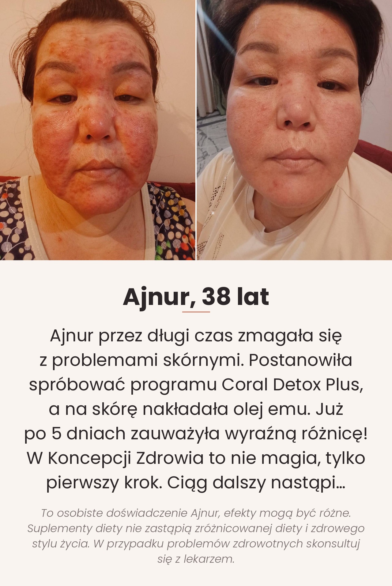 Zestaw Coral Detox Plus Zestaw Coral Detox Plus