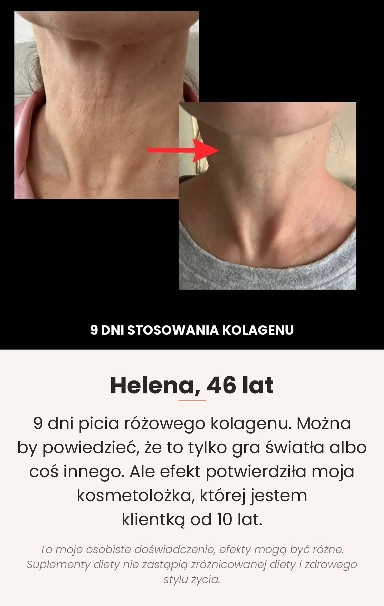 Tripeptides Collagen Promarine (3×10 fiolek) Tripeptides Collagen Promarine (3×10 fiolek)
